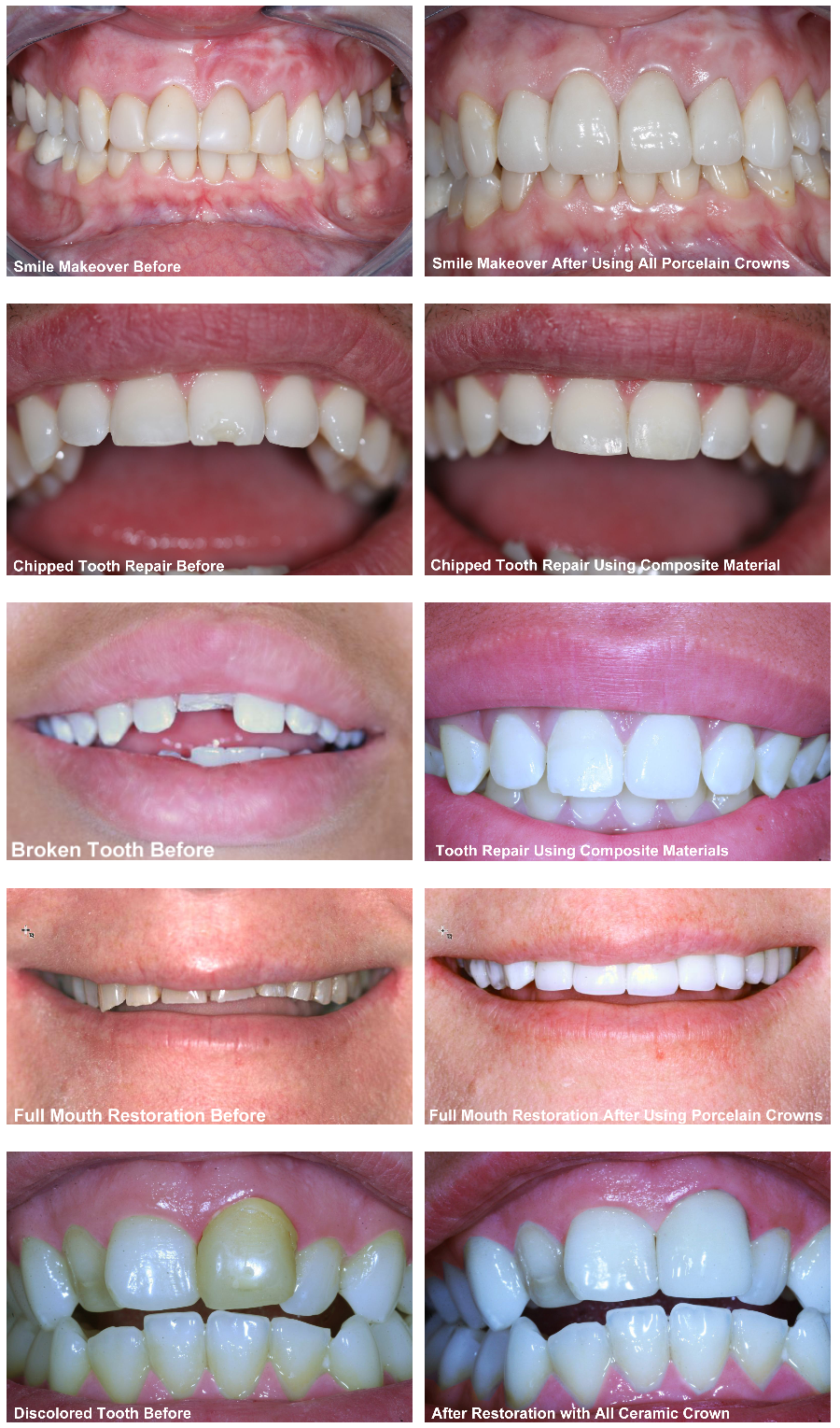 Invisalign in Port Orange | Teeth Whitening in Port Orange | Cosmetic ...